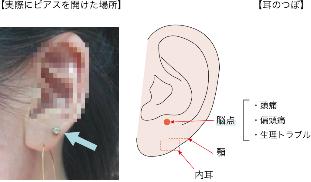 ピアスと頭痛の関係はあるのか 耳つぼの影響を考える ハイイロネコの部屋
